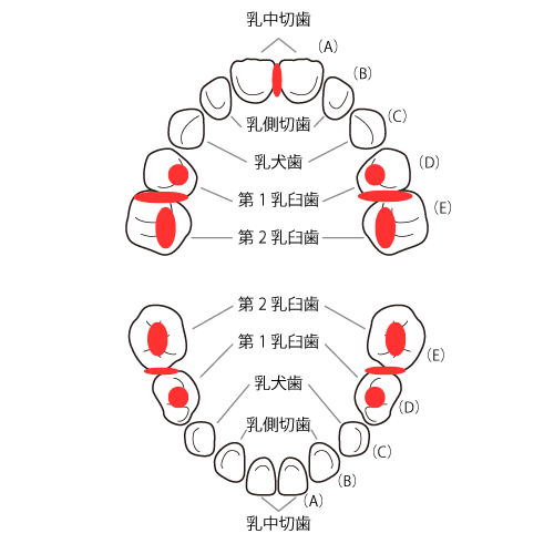 乳歯の虫歯になりやすい場所