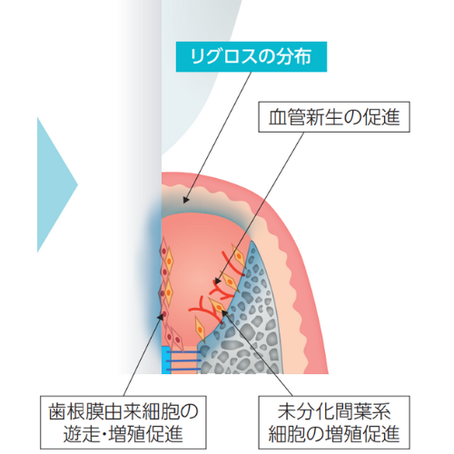 リグロスの分布